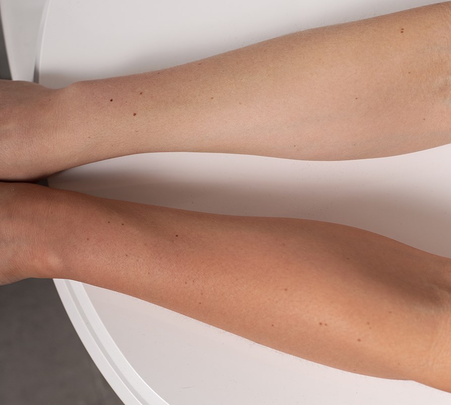 Selvbruner spray fr og efter.